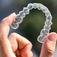 Nouvelle technologie : aligneurs dentaires orthodontiques transparents pour adultes, accessoires de blanchiment dentaire multi-usages avec étui