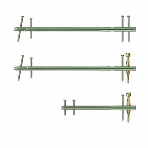 Professionele Hoge Kwaliteit Titanium Dfn Distale <span class=keywords><strong>Femur</strong></span> Intramedullaire In Elkaar Grijpende Nagel Orthopedische Chirurgische Instrumenten Basis - Product Image 4