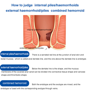 Cổ Phiếu Sẵn Sàng Nhanh Chóng Cứu Trợ Bshipro Thảo Dược Trĩ Kem Làm Mềm Mại Đau Sưng Ngứa Sửa Chữa Da Tự Nhiên Cơ Thể - Product Image 4