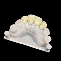 Couronne en zircone de porcelaine E-max à externaliser |   Restaurations dentaires de précision avec technologie E-max et zircone