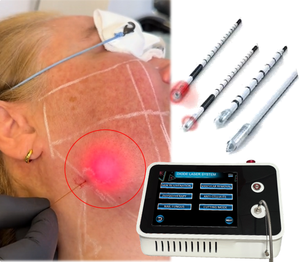 Máquina portátil de endoláser láser de fibra óptica de 1470nm para resultados efectivos de liposucción de lipólisis de Estiramiento facial-Plástico de calidad - Product Image 1