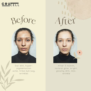 2025 Offre Spéciale Peel mandélique Crucell de haute qualité 30ml Peel chimique profond pour l'élimination de l'hyperpigmentation du visage Blanchiment de la peau - Product Image 4
