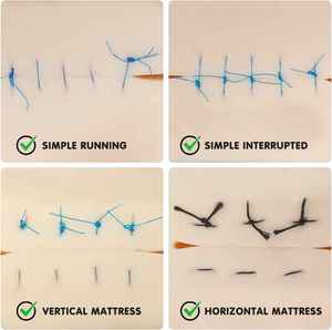 Kit de suture de qualité supérieure, kit de suture d'instrument médical ensemble d'outils d'instruments de formation de suture portables Kit de tampon de peau de modèle de pratique - Product Image 6