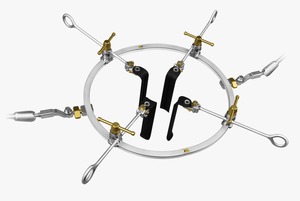 Ensemble de rétracteurs lombaires antérieurs OEM ALTM, qualité supérieure, instruments de chirurgie orthopédique de la colonne vertébrale, produits approuvés CE par Mahersi - Product Image 5