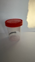 Fábrica de contenedores de muestras de esputo y contenedor de muestras de heces estériles Contenedores de recolección de muestras de orina de China