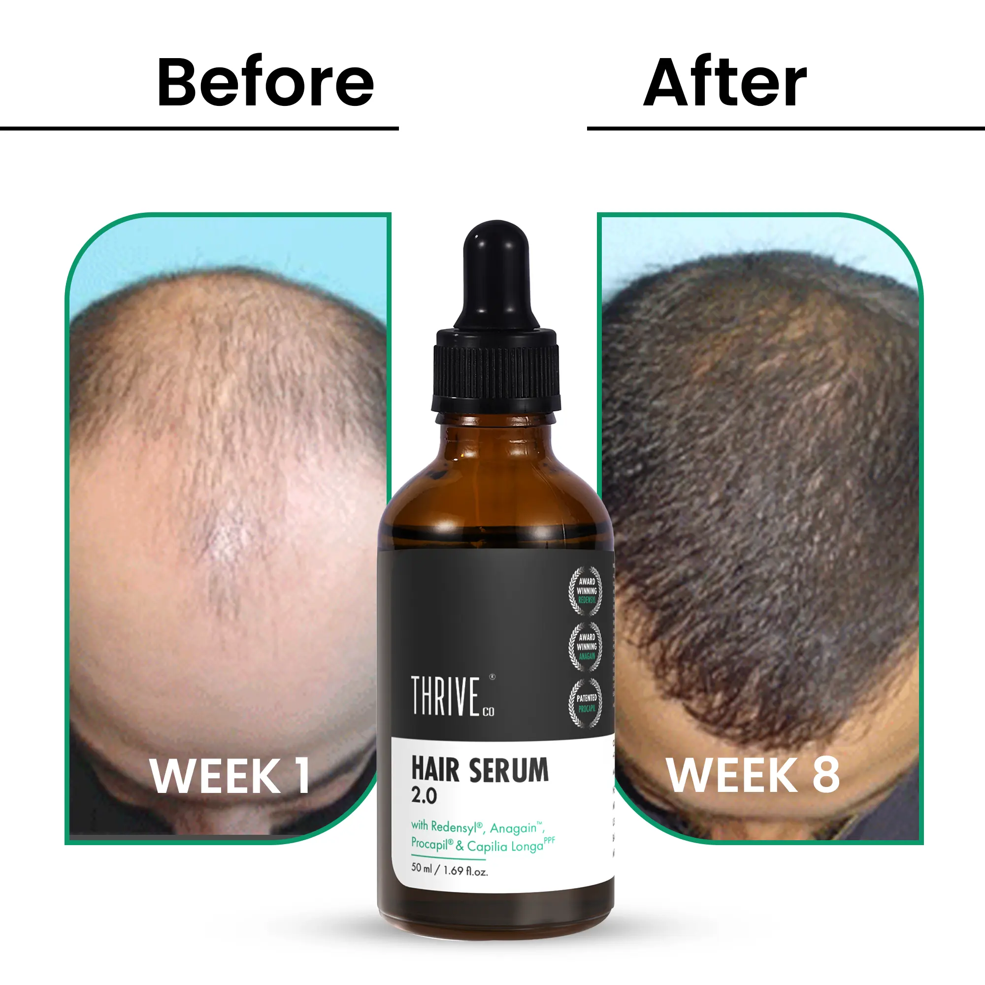 Advanced Hair Growth Serum Promotes Regrowth Reduces Hairfall for Men and Women