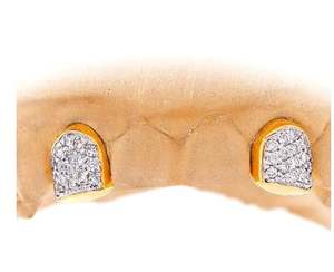 Personnalisé 2X2 Fine Grillz 14K Jaune Blanc Rose Or Incisive Diamant-Poussière Canine Double Caps pour Mariages - Product Image 1