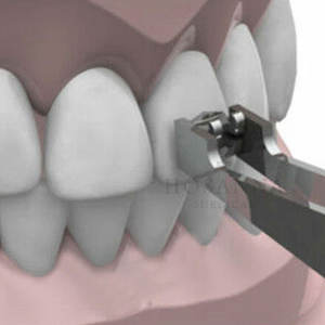 Pince à épiler pour support dentaire de qualité supérieure Prix de gros Source d'alimentation manuelle - Product Image 5