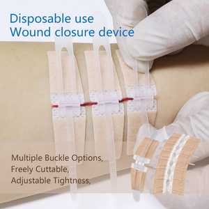 Thiết bị đóng vết thương phẫu thuật không có mũi khâu để sử dụng khẩn cấp - Product Image 2