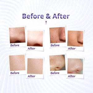 Temizleyici nemlendirici cilt bakımı için 3In 1 elmas mikrodermabrazyon makinesi - Product Image 6