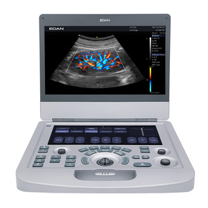 Échographe <span class=keywords><strong>portable</strong></span> <span class=keywords><strong>Edan</strong></span> Acclarix AX2 VET avec deux sondes, échographe Doppler couleur vétérinaire compact - Product Image 3