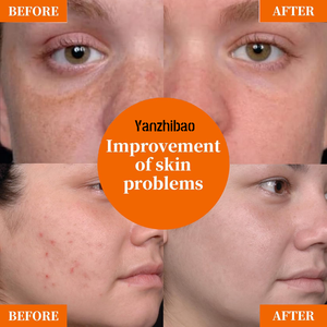 เซรั่มวิตามินซี 20% สำหรับผิวหน้า ผสมไฮยาลูรอนและกรดอะมิโน ช่วยเติมความชุ่มชื้นและกระชับผิว ลดเลือนริ้วรอยและต่อต้านวัย - Product Image 4