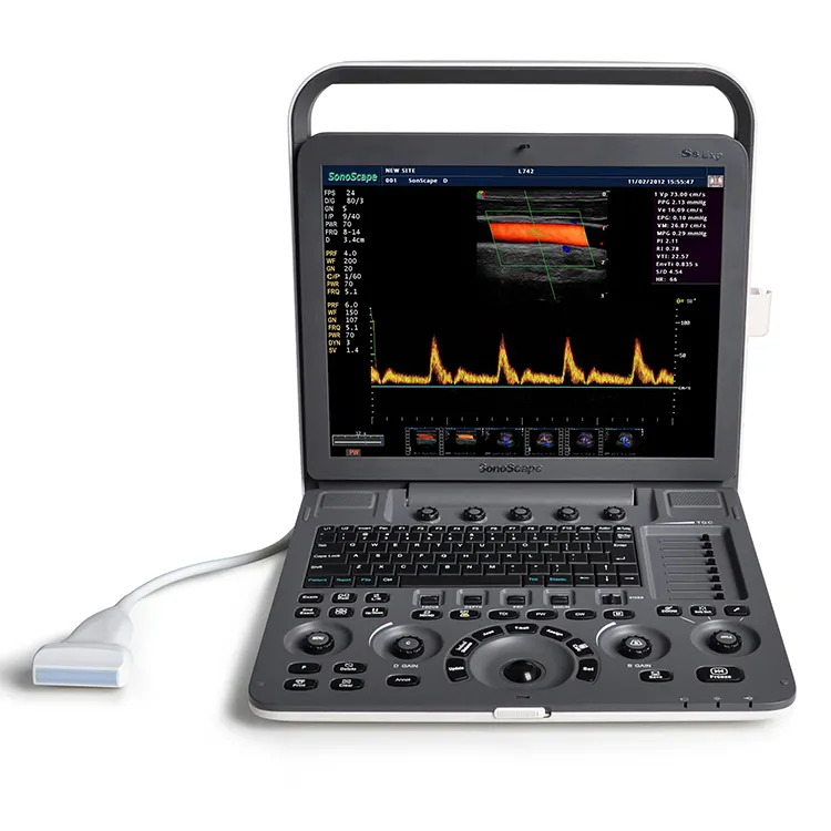 Scanner à ultrasons 4D 3D Sonoscape S8exp Abodominal Doppler à usage médical