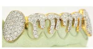 Joyería Dental de Lujo Personalizada para Regalo de Compromiso, Grillz de Plata de Ley 925 con Diamantes de Moissanita y Polvo de Diamante - Product Image 4