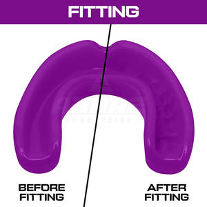 Training Ready With Durable And Flexible Material Boxing <b>Mouth</b> <b>Guard</b> <b>Sports</b> Safety Solution - Product Image 6