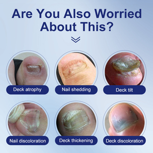 Líquido Reparador de Uñas Herbal Pro Formula, Trata la Infección Fúngica de las Uñas, Restaura las Uñas Dañadas, Solución de Cuidado Suave OEM/ODM Personalizada - Product Image 3