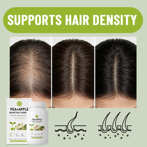 Tabletas de Apoyo al Crecimiento del Cabello con Fórmula Natural a Base de Plantas, Personalizables, <span class=keywords><strong>para</strong></span> la Salud del Cabello y la Pérdida del Cabello - Product Image 2