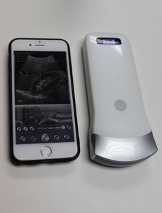 Sans fil android/ios réseau convexe usb sonde à ultrasons scanner à ultrasons ultrasons <span class=keywords><strong>de</strong></span> <span class=keywords><strong>poche</strong></span> à <span class=keywords><strong>prix</strong></span> <span class=keywords><strong>de</strong></span> vente - Product Image 2