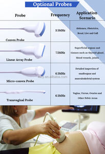 DYX Hoogwaardige draagbare veterinaire echografie <span class=keywords><strong>Doppler</strong></span>-apparaat Prijs voor dieren - Product Image 2