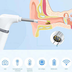 Otoscope chirurgical professionnel Astrin, instrument médical manuel, acier inoxydable, lumière haute luminosité fiable, optique de précision - Product Image 2