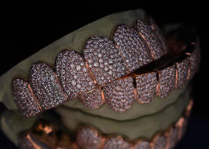 Grillz personnalisés en or rose, entièrement sertis de diamants, pour dents supérieures et inférieures, VVS1 Moissanite, bijoux hip-hop pour le corps - Product Image 5