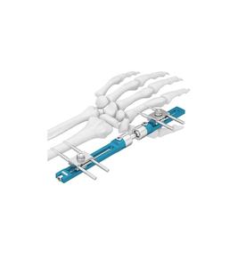 Nuevo Producto en Oferta 2025, Sistema de Fijación Externa de Húmero Médico Profesional de Primera Calidad Personalizado de 5 mm - Product Image 4