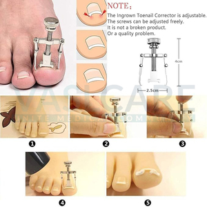 Cortaúñas DE LOS PIES Herramienta de uñas encarnadas para uñas encarnadas y gruesas Tratamiento de uñas encarnadas Kit de eliminación de uñas quirúrgicas de Vaslcare - Product Image 3