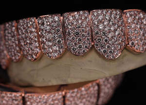 Grillz personnalisés en or rose, entièrement sertis de diamants, pour dents supérieures et inférieures, VVS1 Moissanite, bijoux hip-hop pour le corps - Product Image 2