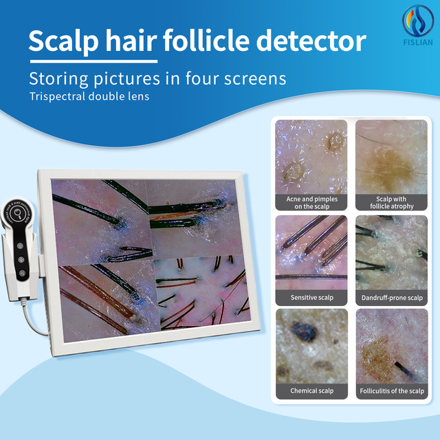 High Precision Desktop Hair Scalp Scanner Analyzer for Detecting Dandruff Hair Thinning and Skin Wrinkles for Professional Use