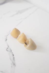 Anillo de Cuerno de Búfalo Pulido, Joyería para Fiestas, Bodas y Aniversarios, Color Natural, Gran Venta - Product Image 2