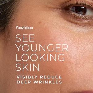 เซรั่มบำรุงผิวหน้า OEM ลดเลือนริ้วรอยลึกด้วยเรตินอลและแอสคอร์บิก แอซิด ช่วยลดเลือนริ้วรอย จุดด่างดำ และรอยแผลเป็นจากสิว - Product Image 2