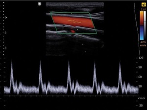 Ecógrafo Samsungg UGEO HM70A - Product Image 6