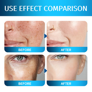 Suero Facial Coreano OEM ODM para Reafirmar y Reparar la Piel, Serie <span class=keywords><strong>de</strong></span> Péptidos <span class=keywords><strong>de</strong></span> Cobre Azul GHK-Cu con Ácido Hialurónico, Estimula el Colágeno - Product Image 5