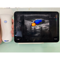 Escáner de Ultrasonido Inalámbrico Joymi 8L con Sonda Lineal, 7.5/10MHz, 192 Elementos, 64 Canales, para Uso Vascular, MSK, Nervios y Tiroides