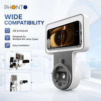 Adaptador de Lámpara de Hendidura de Alta Resolución con Conexión Directa a Aplicaciones de Smartphone (iOS y Android) - Módulo de Imagenología para Pruebas Oculares