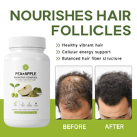 Comprimés de croissance capillaire à base de plantes pour cheveux clairsemés et perte de cheveux – Complément alimentaire à base de plantes pour soutenir la repousse des cheveux clairsemés