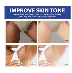 Crema Aclarante para Rostro, Cuerpo, Axilas, Codos, Parte Interna del Muslo y Áreas Sensibles, Cuidado de Manchas Oscuras, Cuidado de la Piel - Product Image 2