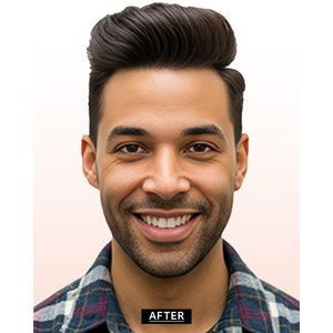 Prótesis Capilar Australiana de Encaje para Hombre con Cabello Humano 100% Remy para Solución de Pérdida de Cabello - Product Image 4