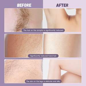 Rasoir électrique rechargeable pour femmes avec double lame, utilisation humide et sèche, étanche IPX7, pour le corps et la zone du bikini, tondeuse lavable - Product Image 4