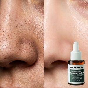 Solution exfoliante BHA 2% 1,0 fl oz, exfoliant liquide BHA pour les pores dilatés, les rides et les ridules, avec extrait d'herbes - Product Image 3