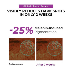 סרום ניאצינמיד 20% פרטי, גלוטתיון TXA להסרת כתמים כהים, להבהרת וליצירת זוהר לעור רגיש - Product Image 2