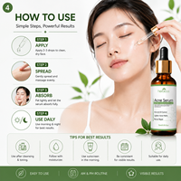 Sérum Anti-Acné à 2% d'Acide Salicylique BHA, Traitement Visage à la Niacinamide, Élimination des Cicatrices, Atténuation des Marques d'Acné, Apaisement des Rougeurs, Marque Privée OEM