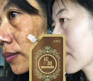Whitening Whitening Freckle Removal Cream Authentic Improve Dark yellow and lighten Recombination to remove sun spots freckles