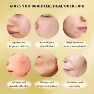 Crema de Cúrcuma y Vitamina C: Corrige la melanina, desvanece las manchas oscuras y las marcas del acné, controla la grasa y combate el acné, calma el enrojecimiento. - Product Image 5