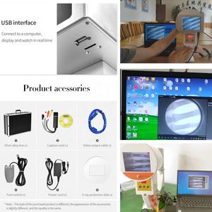 携帯型<span class=keywords><strong>X</strong></span>線装置携帯型蛍光透視装置 - Product Image 6