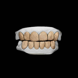 Grillz en or 10K sur mesure, fabriqué à la main, à 6 dents, motif croisé, finition diamantée texturée, pour dents supérieures CONCEPTION GRILLZ17 - Product Image 1