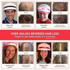 Système de croissance capillaire laser professionnel IRestores 282 avec batterie intégrée, nouveau stock, best-seller, original - Product Image 5