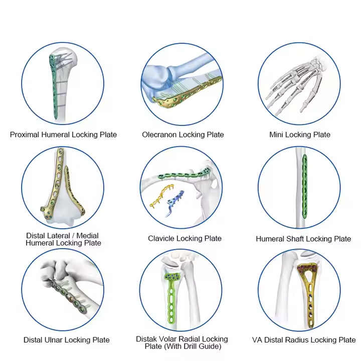 Titanium LCP Mini & Micro Fragment Locking Plate System 1.5/2.0/2.4 mm Modular Fixation Set for Trauma Reconstruction