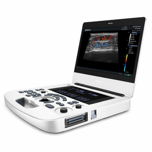 Échographe <span class=keywords><strong>portable</strong></span> <span class=keywords><strong>Edan</strong></span> Acclarix AX2 VET avec deux sondes, échographe Doppler couleur vétérinaire compact - Product Image 1