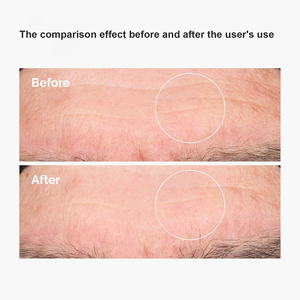 Suero Facial de Ácido Hialurónico + <span class=keywords><strong>B5</strong></span> de Marca Privada 1oz - Hidratación Profunda y Reparación de la Barrera Cutánea con Ceramida para una Piel Más Tersa y Voluminosa - Product Image 5